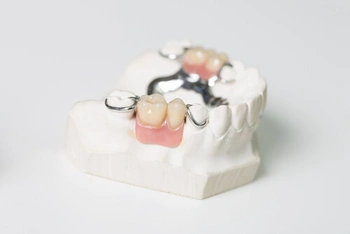 How Long Do Dentures Take to Make partial